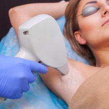 Most Searched Hair Removal Techniques Nowadays